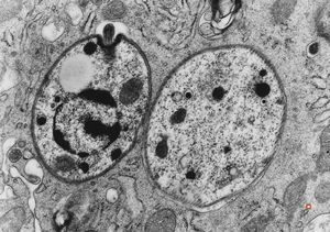 M,28y. | Leishmania - skin M,28y. | Leishmania - skin